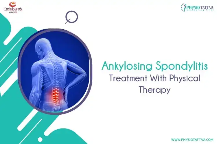 Ankylosing Spondylitis: Treatment With Physical Therapy