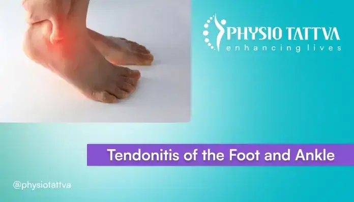 Foot & Ankle Tendonitis - Causes, Symptoms & Treatments 