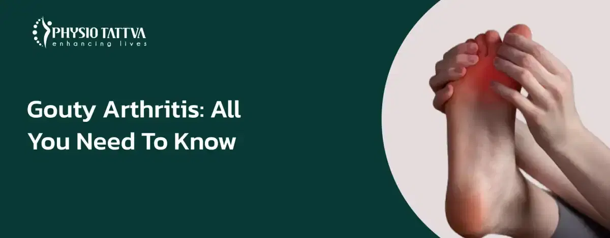 Everything You Should Know about Gouty Arthritis