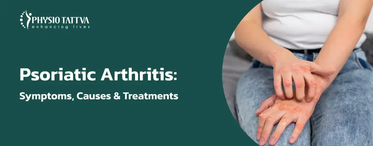 Psoriatic Arthritis: All You Need to Know