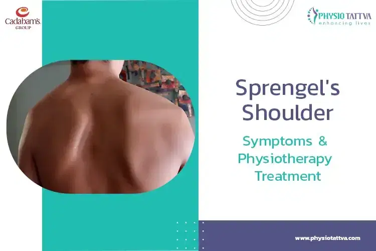 Sprengel's Shoulder | Symptoms & Physiotherapy Treatment