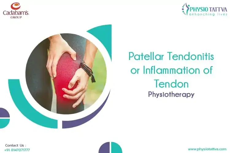 Patellar Tendonitis or Inflammation of Tendon| Physiotherapy