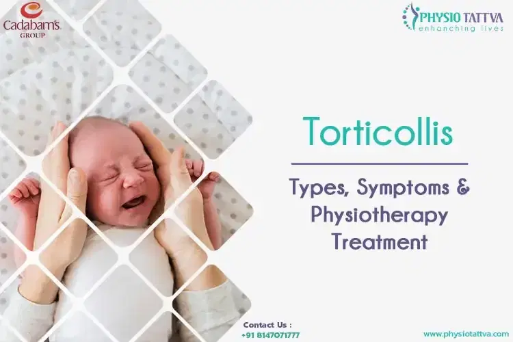 Torticollis | Types, Symptoms & Physiotherapy Treatment