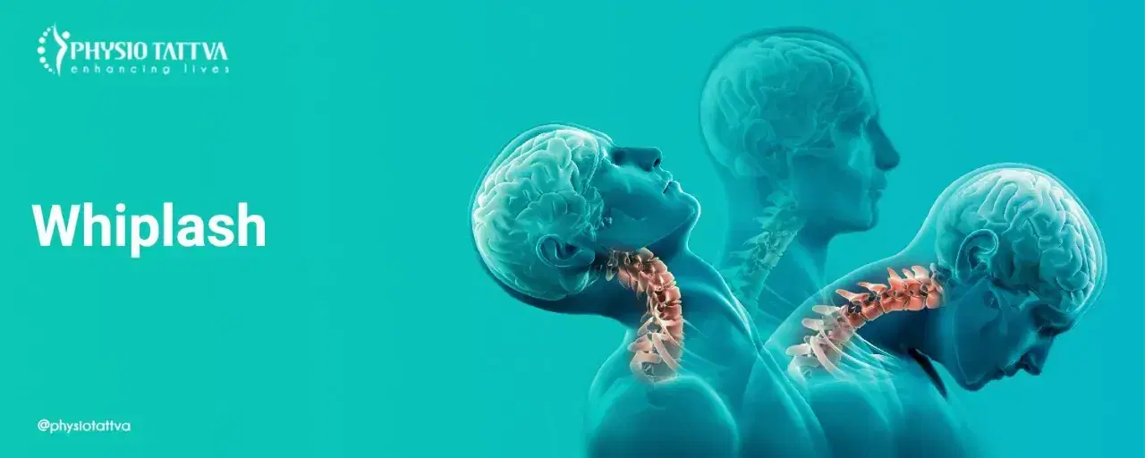 Understanding Whiplash (Neck Strain)
