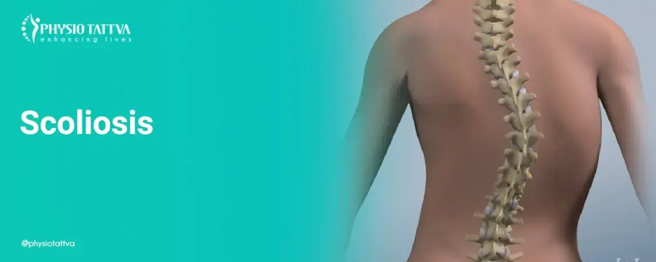 Scoliosis