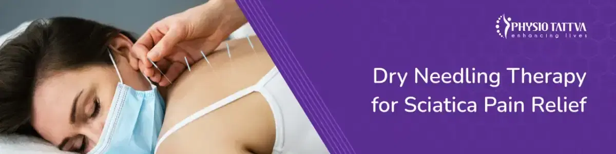 Dry Needling Therapy for Sciatica