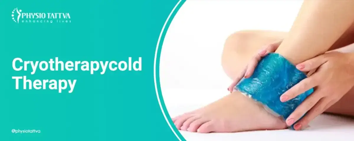 Cryotherapy (Cold Therapy)