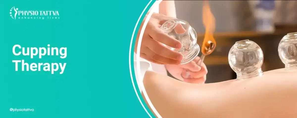 Cupping Therapy