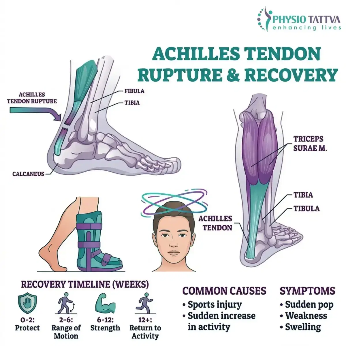Kinesio Taping Therapy for Achilles Tendon Rupture